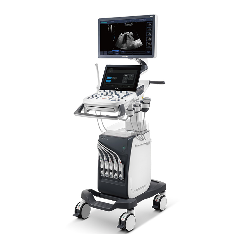Ultra Sound Scan Sonoscape